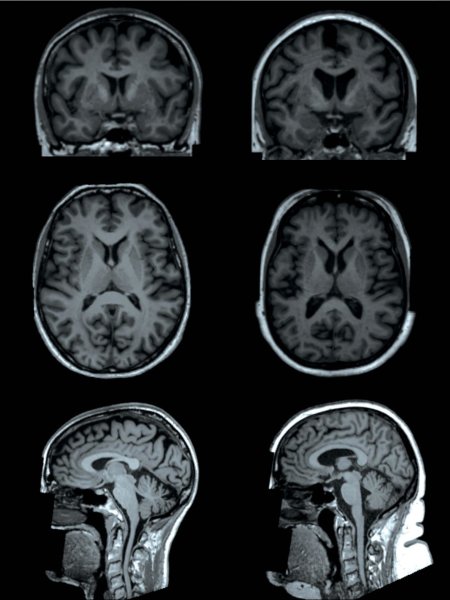 20190428-Brain.jpg