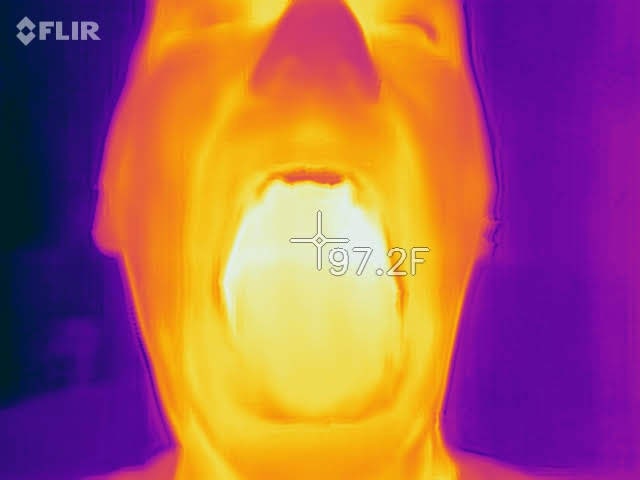 20200414.Can-You-Use-an-Infrared-Camera-to-Detect-a-Fever-10.jpg